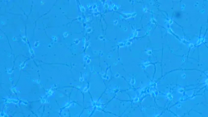 神經(jīng)元集中在哪里(神經(jīng)元知乎)